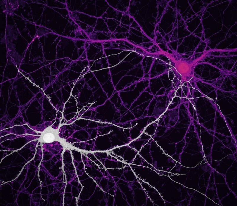 9 место: связи между нейронами морского конька (клетки мозга). (Фото Jason Kirk & Quynh Nguyen/Nikon Small World Photomicrography 2020):
