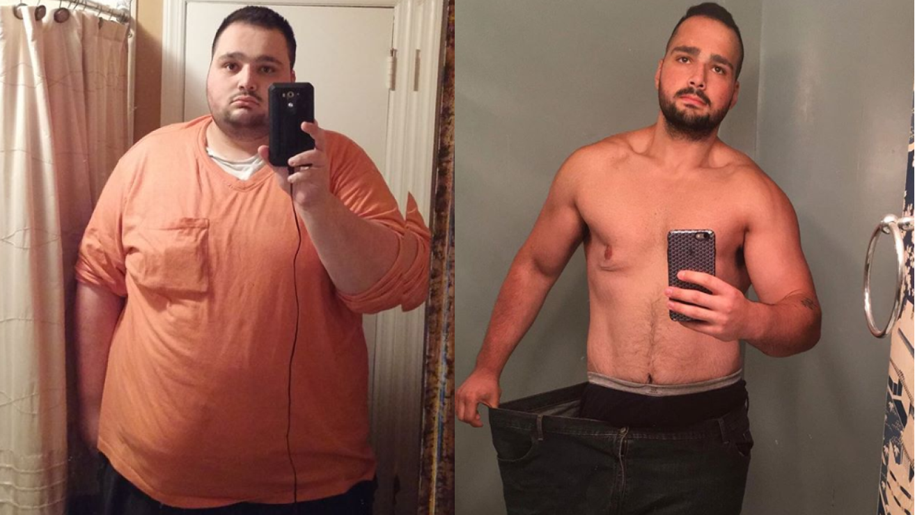 До и после похудения мужчины.