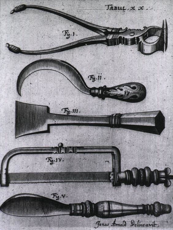 Инструменты для ампутации, 1666 г.
