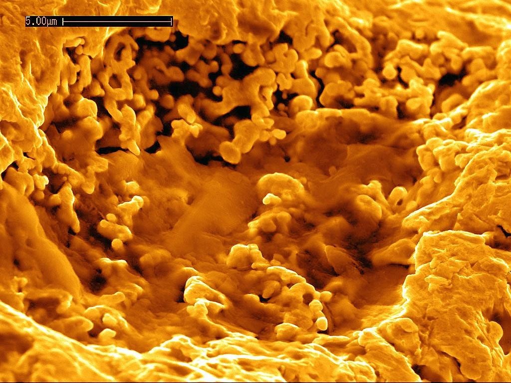 Cupriavidus metallidurans — бактерия, обожающая тяжёлые металлы