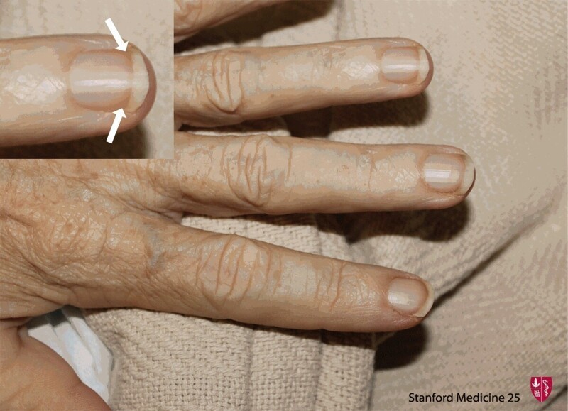Научная хиромантия: о чём говорят ваши руки?