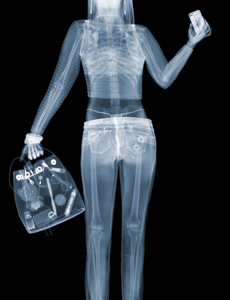 8 ноября 1895 г. 125 лет назад, физик Вильгельм Рентген открыл «рентгеновские лучи»