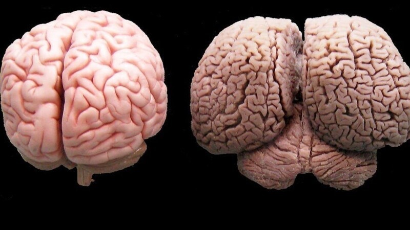 Какого цвета мозги у человека фото