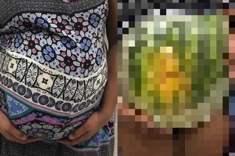 Полицейские Сан-Паулу задержали беременную с необычной начинкой в животе