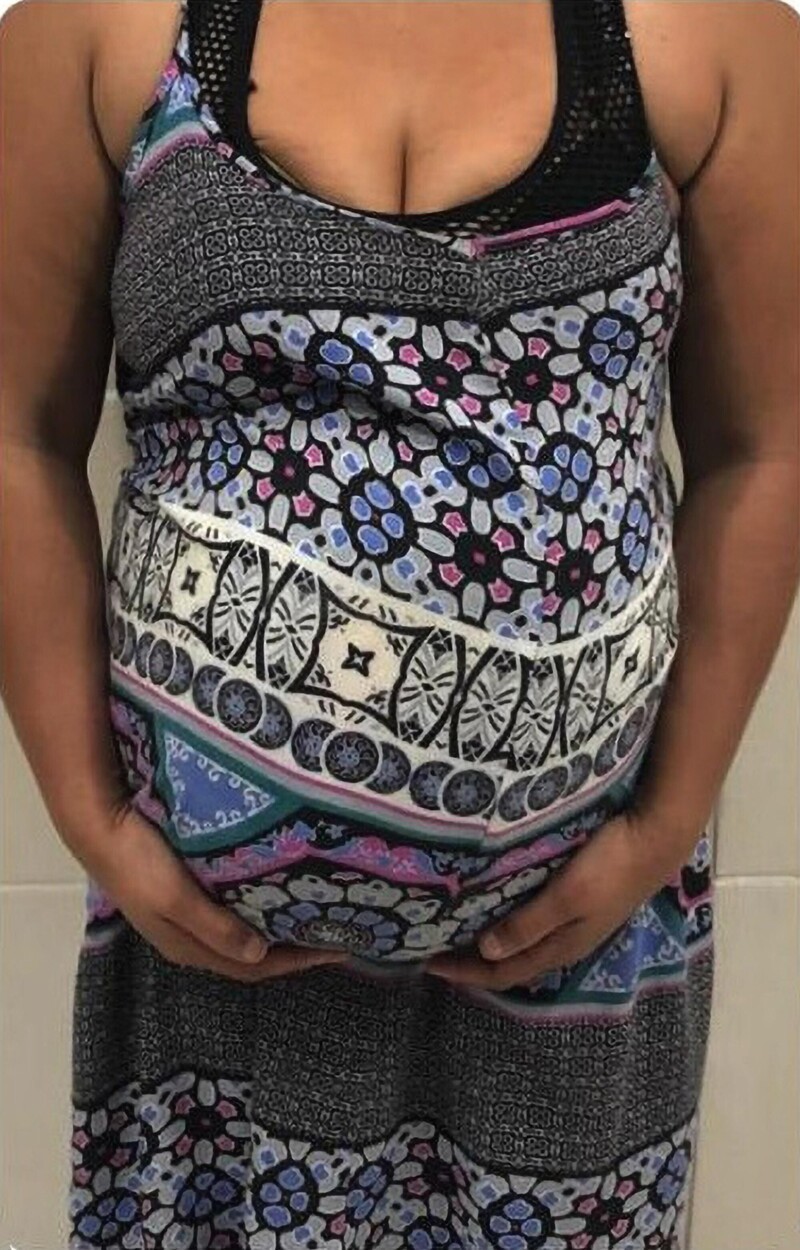 Полицейские Сан-Паулу задержали беременную с необычной начинкой в животе