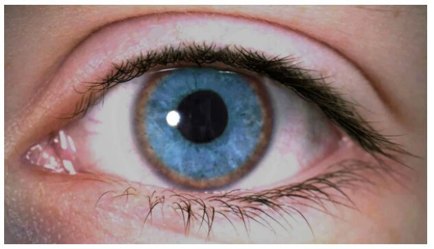 "Красивые глаза" как симптом болезни