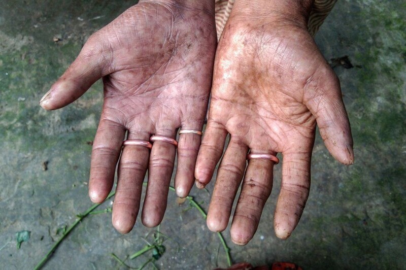 Жизнь без отпечатков пальцев: тяготы семьи из Бангладеша