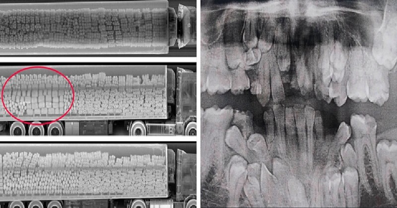 Рентгеновские снимки, которые открывают мир с неожиданной стороны