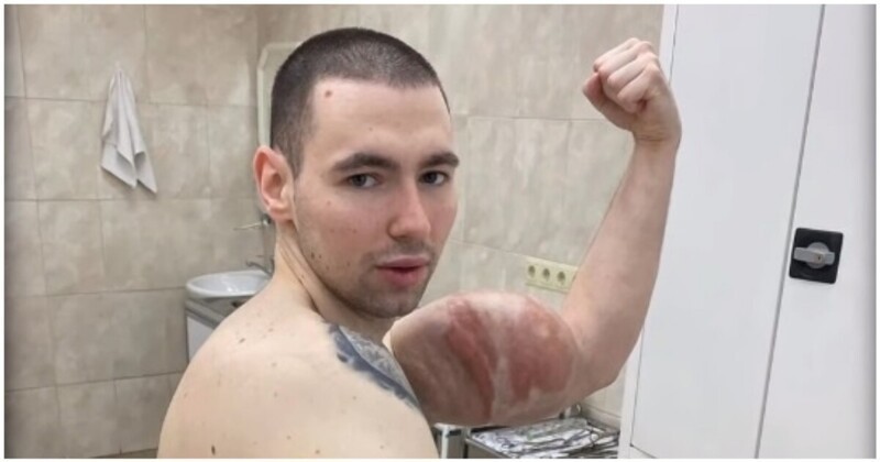 Кирилл Терешин продолжает сдувать свои «руки-базуки» и хвастается шрамами
