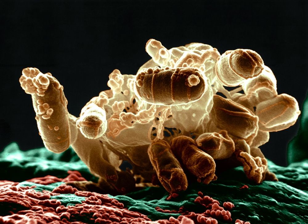 Бактерии на грязных руках фото под микроскопом