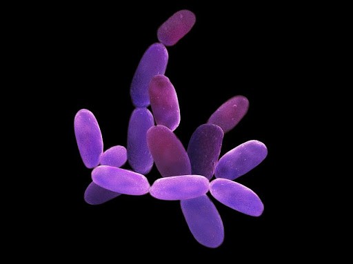 Археи - бактерии, живущие на океаническом дне, без света и питаются они метаном, а "дышат" серой или металлом вместо кислорода