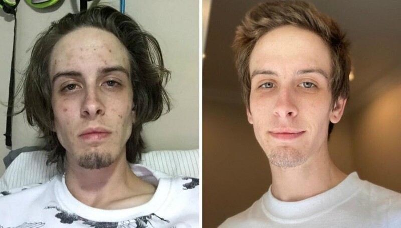 Фото до и после моей реабилитации от наркозависимости