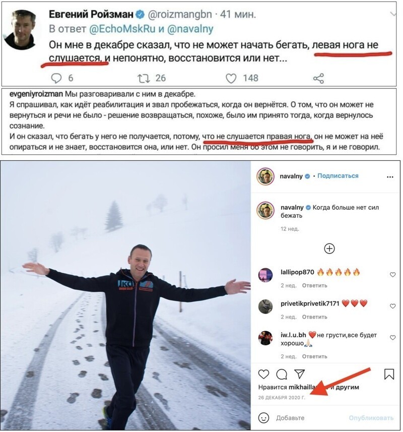 Так все-таки какая именно нога болит у Навального?