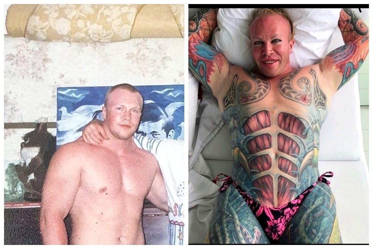 Александр шпак до и после операции фото