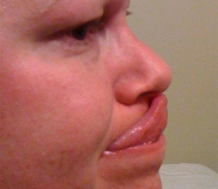 33. Только 10% людей могут коснуться носа языком.