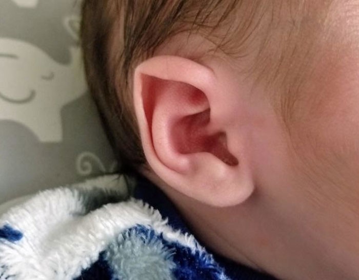 27. Менее 1% людей имеют заостренные, "эльфийские" уши. Это отклонение называют ухом Шталя, обычно оно проходит само по себе.