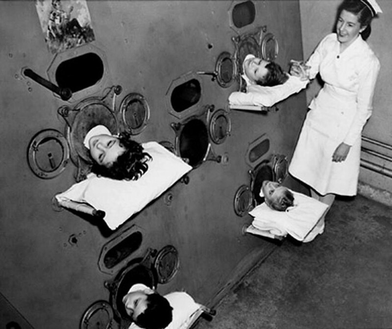Дети в камере пониженного давления до появления вакцины от полиомиелита, 1937 г. До изобретения вакцины от полиомиелита пациентов помещали в аппарат "железные легкие", который симулировал дыхание.