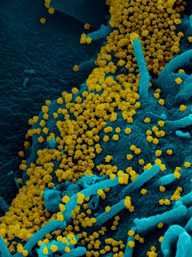 Эксперт: вирус SARS-CoV-2 может существовать в мире с 2013 года