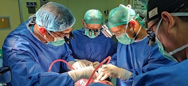 В Израиле провели уникальную операцию по разделению сиамских близнецов