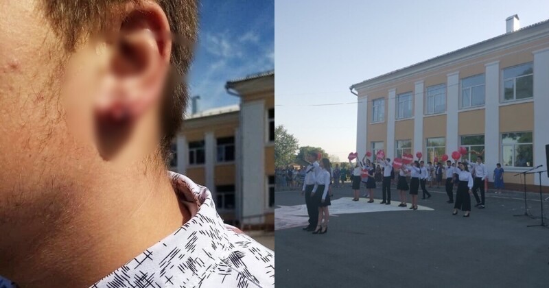 "Не будь п*****м!": директор школы в Курской области порвал ученику ухо, пытаясь снять серьгу