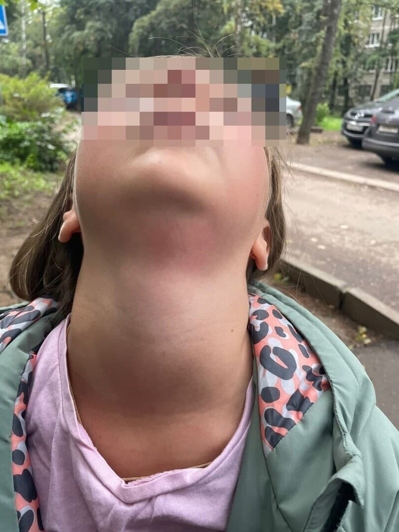 "Страшно, что все шли мимо": в Солнечногорске мужчина напал на девочку, пытаясь отнять телефон
