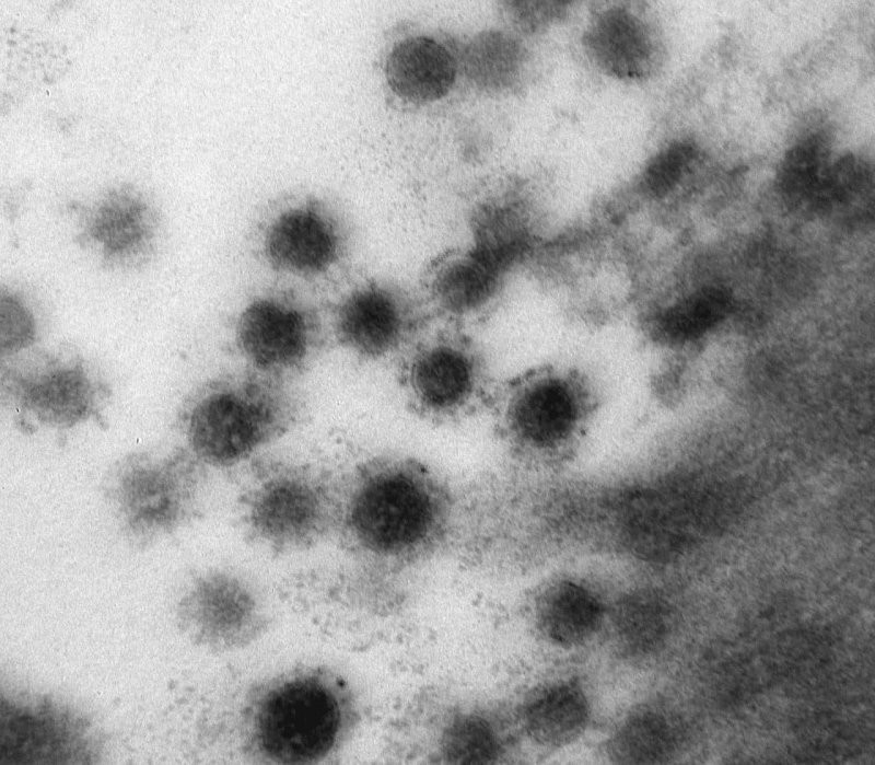 Центр «Вектор» впервые опубликовали снимок смертельного вируса