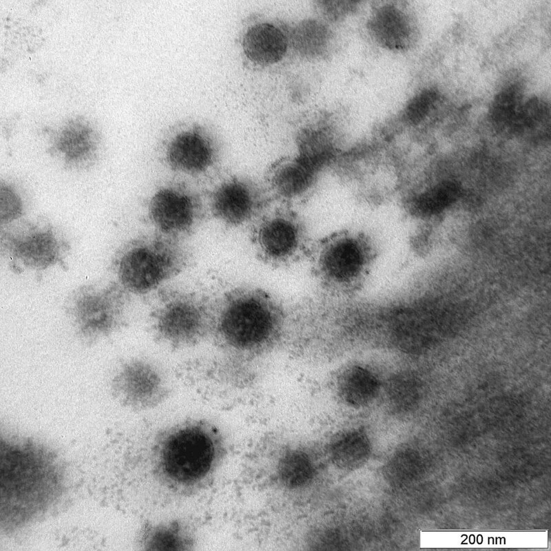 Как выглядит дельта-штамм коронавируса