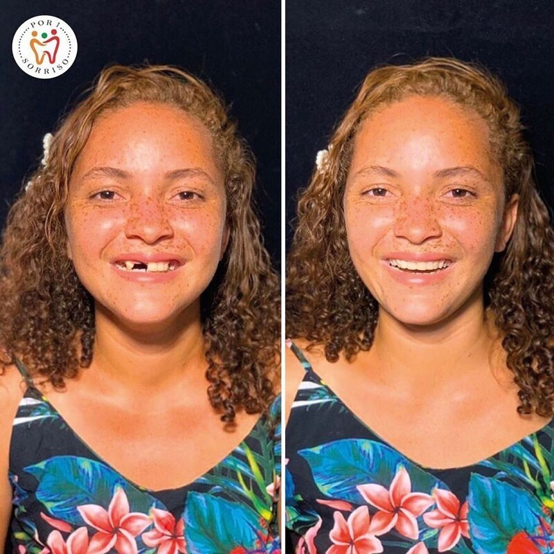 Бразильский стоматолог меняет жизнь бедняков к лучшему