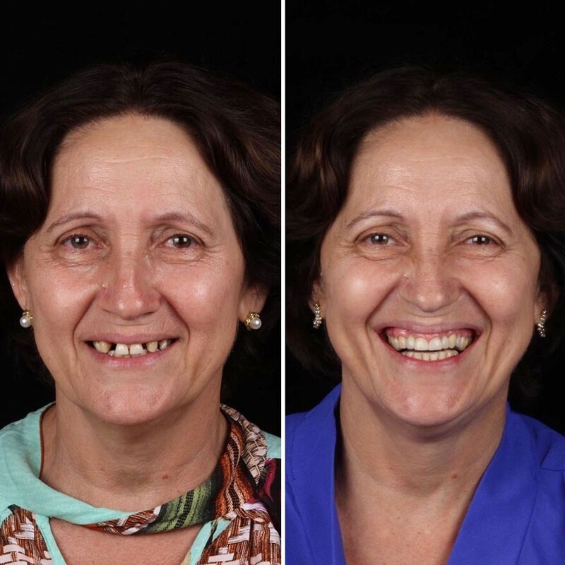 Бразильский стоматолог меняет жизнь бедняков к лучшему