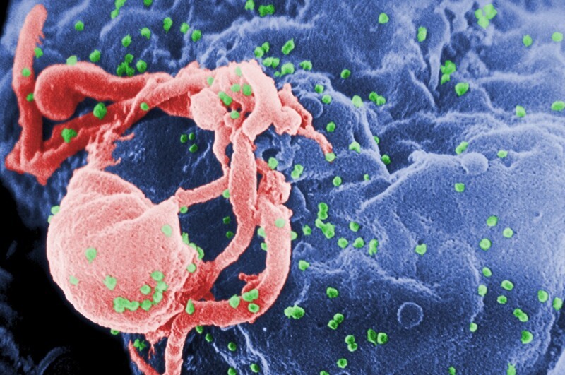 Третий человек в истории полностью вылечился от ВИЧ-инфекции