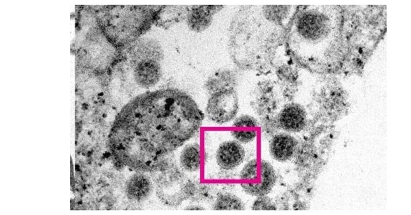 Ученые опубликовали фотографии вируса «Омикрон»