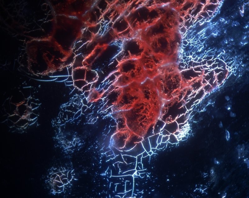 Капля крови под микроскопом похожа на астрофото