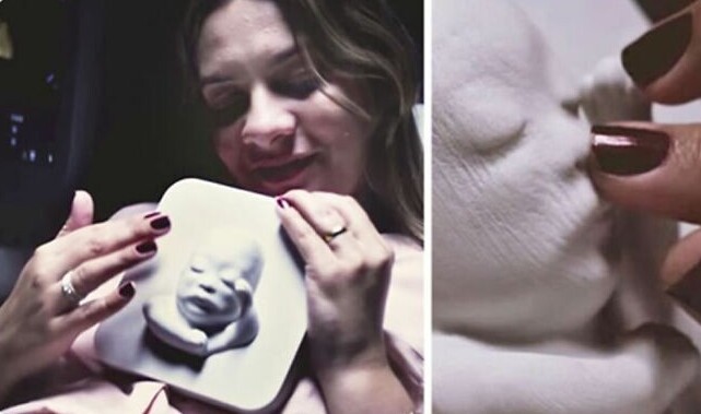 Бразильские врачи печатают результаты УЗИ беременных на 3D-принтере, чтобы слепые родители смогли "потрогать" своих будущих деток
