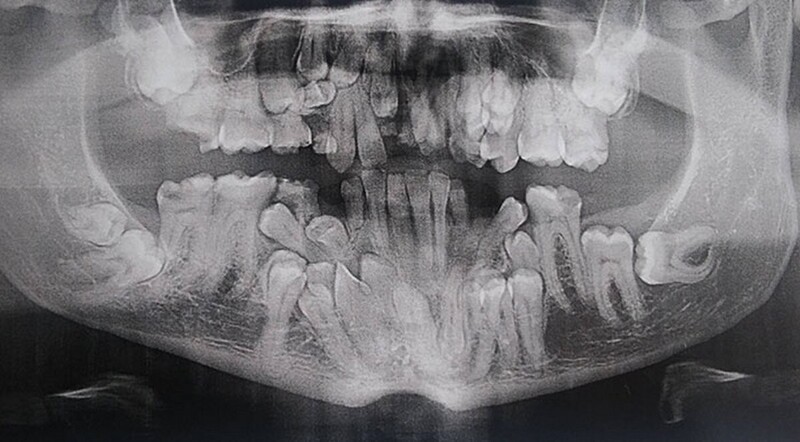 Рентгеновские фотографии, от которых просто невозможно оторвать глаз
