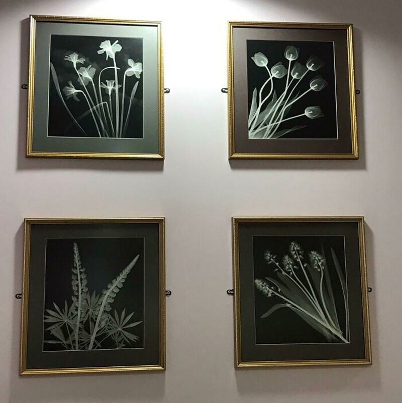 Рентгеновские снимки растений на стене рентгенкабинета в больнице