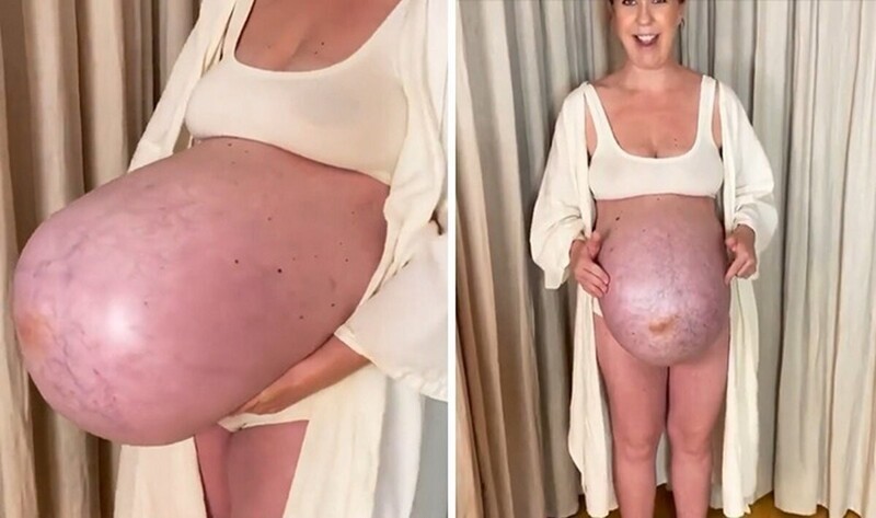 Эта женщина беременна тройней. Роды уже близко!