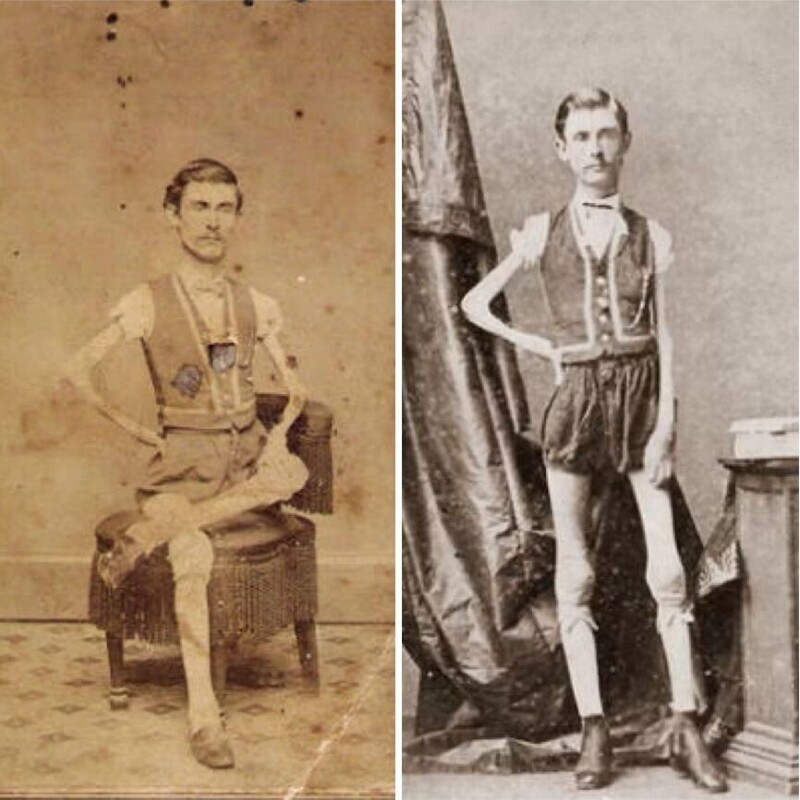 На фото Исаак Спрэг, знаменитый в XIX веке "человек-скелет", который ездил по всему миру и удивлял публику своей незаурядной внешностью.