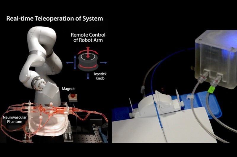 Изобретён робот, который может дистанционно оперировать сосуды