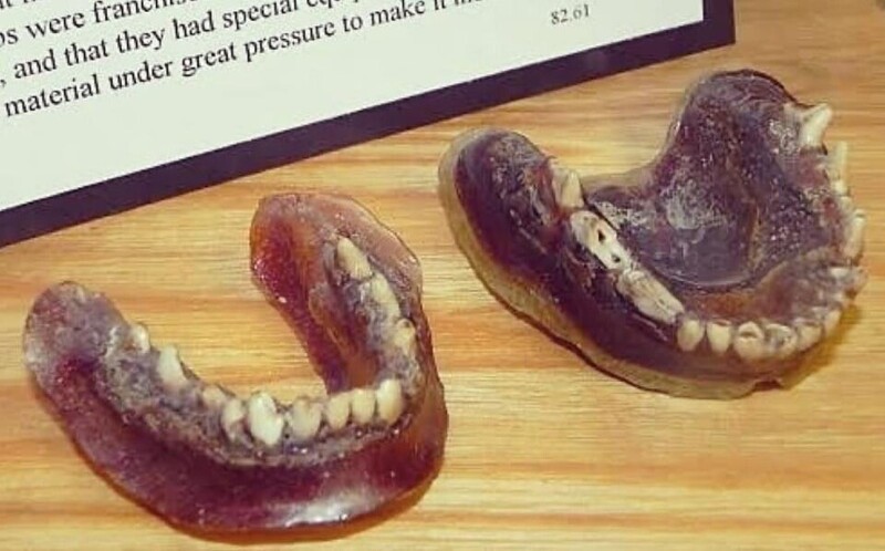 В начале 1900-х годов мужчина не мог позволить себе надлежащий протез, поэтому он сделал свой собственный, используя расплавленные ручки зубной щетки и зубы мертвого койота