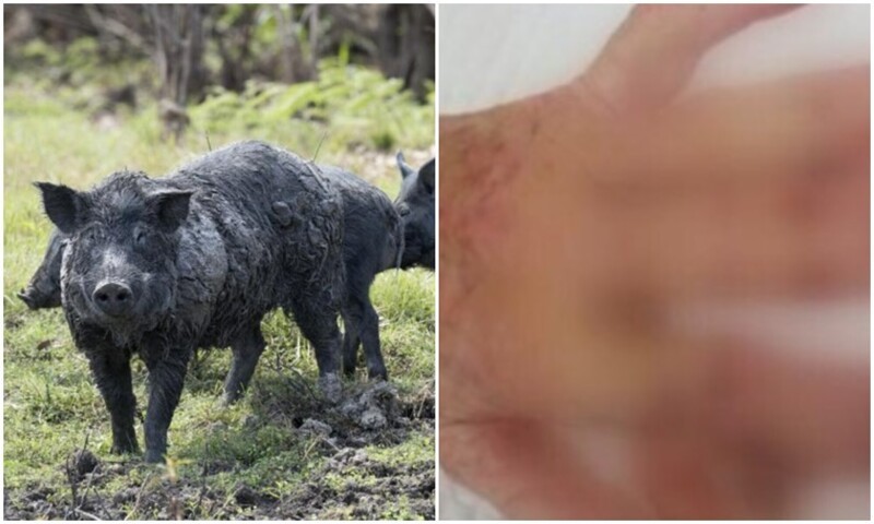 Женщину атаковала дикая свинья, чуть не лишив её пальцев