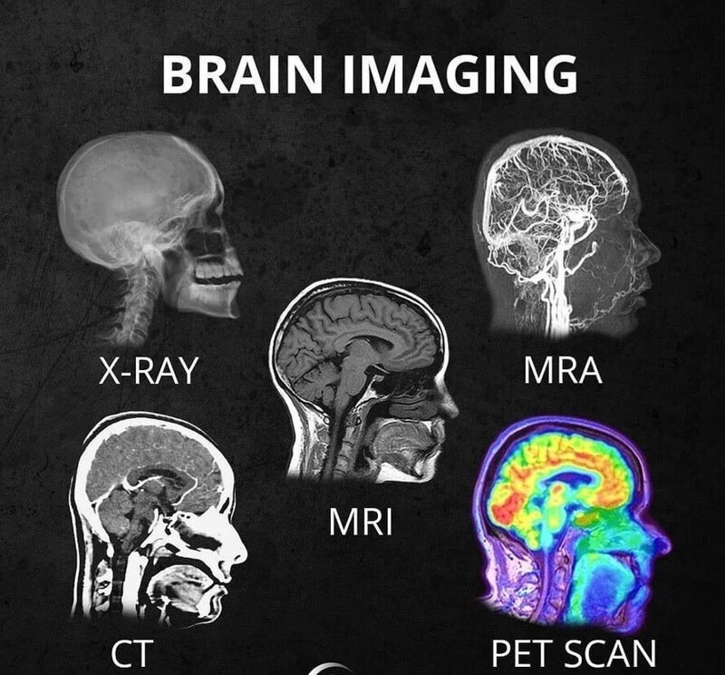 Разные виды снимков мозга - рентген, ангиография, МРТ, КТ, позитронно-эмиссионная томография (ПЭТ)