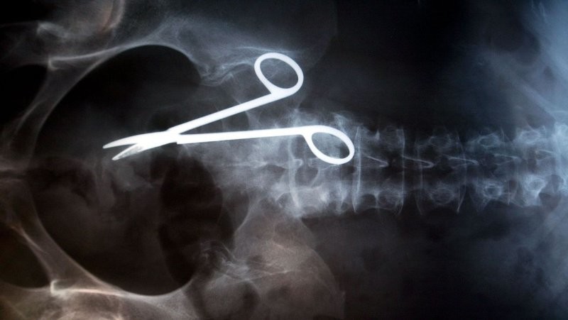 Интересно, как врачи умудряются забыть инструмент, внутри тела пациента? 