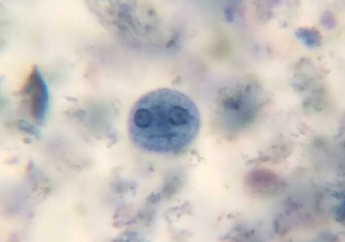Амёба в виде рожицы, которую увидели в микроскоп