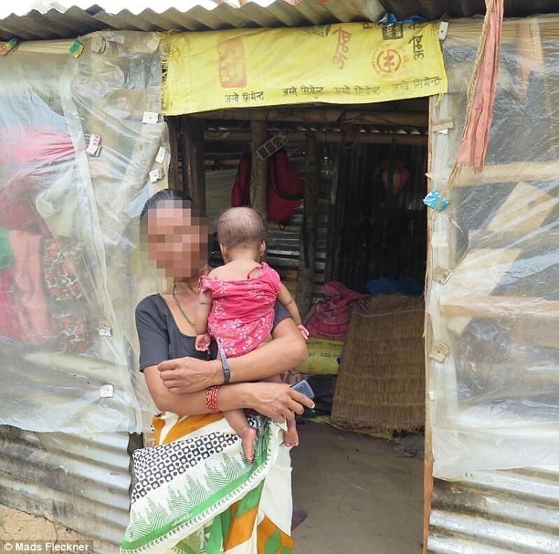 Непальская деревня, где практически у всех жителей только одна почка