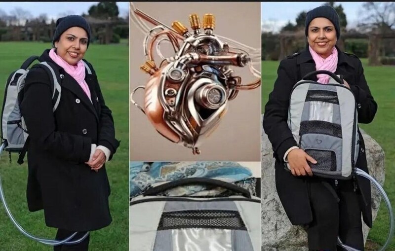 Селва Хуссейн, 39-летняя женщина из Великобритании, имеет полностью искусственное сердце, которое было имплантировано ей в 2017 году. Она носит блок питания в рюкзаке, и весит он около 6 кг. Женщина ждёт донорское сердце