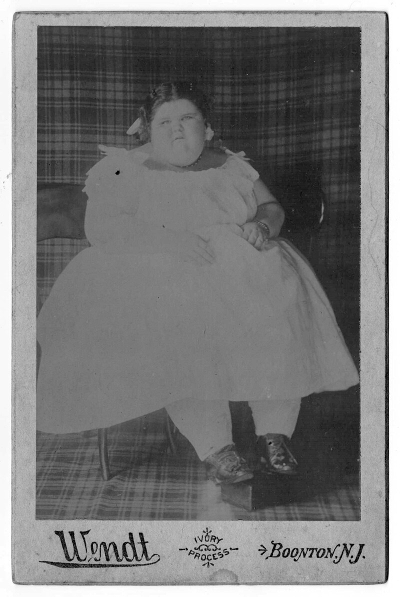 Портрет Перл Рэмбо, 14 лет, вес 276 кг. В детстве она работала на карнавалах, считаясь самой полной женщиной в мире. Она умерла от испанского гриппа в 1918 году