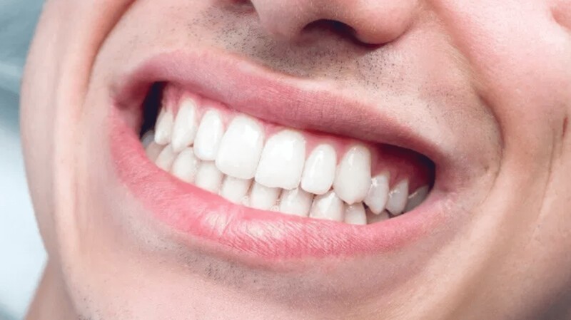 9. Отпечатки зубов также уникальны, как и отпечатки пальцев