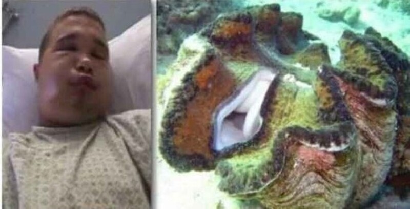 На Гавайах госпитализировали дайвера, который засунул свой пенис в гигантского моллюска