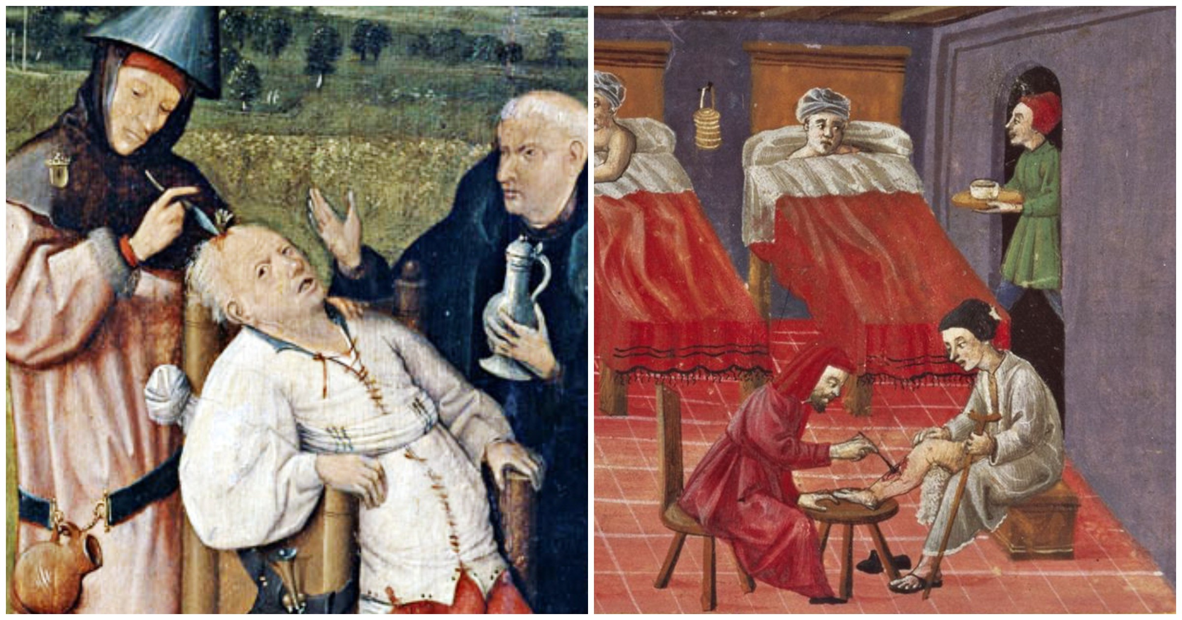 История реаниматологии. Кровопускание в средние века. Пускание крови в древности.