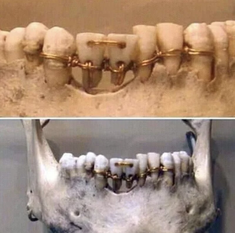 Работа стоматолога 1400-летней давности